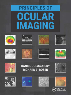 cover image of Principles of Ocular Imaging